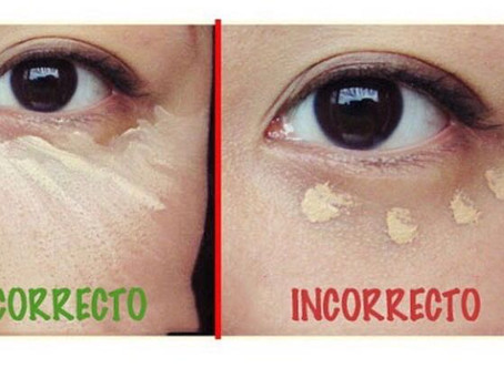 Corrección de ojeras