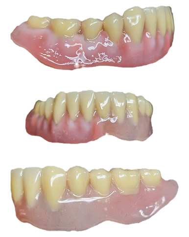 Contoured denture v standard _edited.png