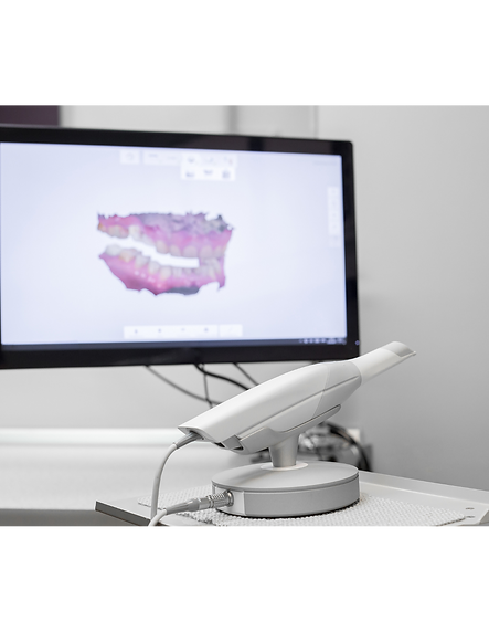 Digital / CAD CAM | Discovery Dental Lab