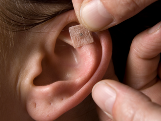 Why am I Getting Acupuncture on my Ear?