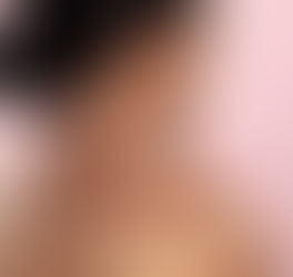 Relief for Shoulder Pain: The Benefits of Acupuncture