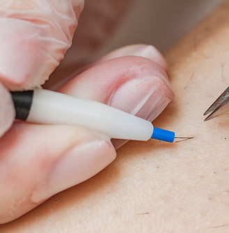 Électrolyse Centre Multi-Soins L'Équilibre