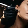 microneedling-2.webp