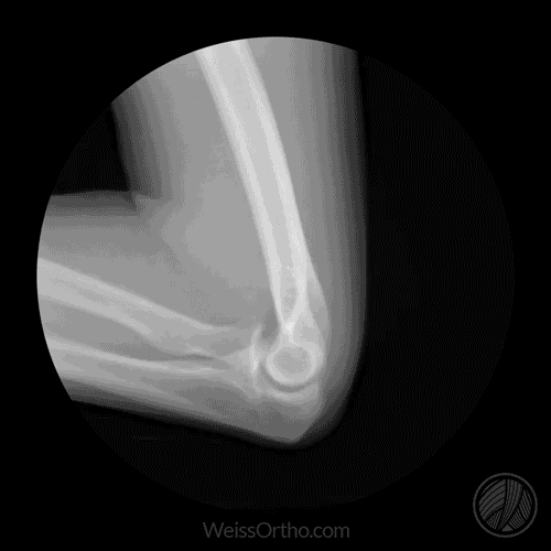 elbow-x-ray-gif.gif