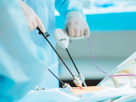 Entendendo a Cirurgia de Vesícula Biliar por Videolaparoscopia e Seus Benefícios