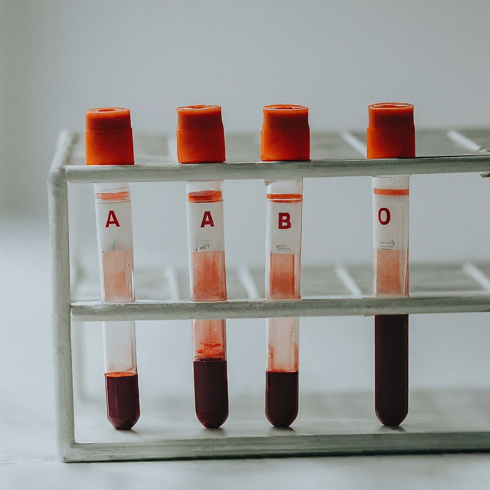 TME 14: Understanding the Basics: How Blood Group Testing Works