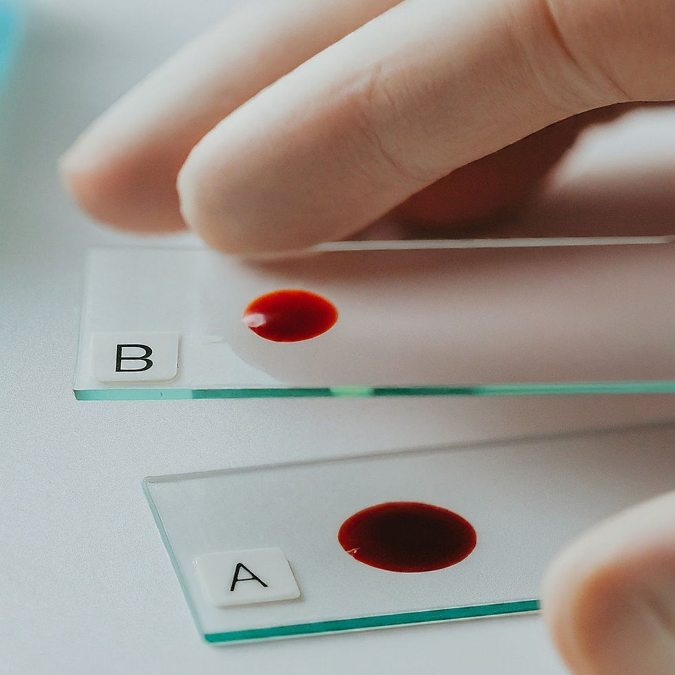 TME 14: Understanding the Basics: How Blood Group Testing Works