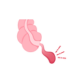 apendicitis