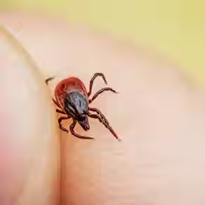Mordedura de garrapata: cómo reaccionar para evitar contraer la enfermedad de Lyme