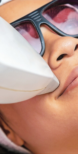 Upper Lip Laser Hair Removal_edited.jpg