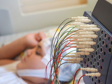 Data of Children Treated with Cannabis Based Medicinal Products for Treatment Resistant Epilepsy