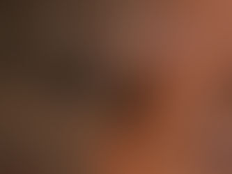 Advierten sobre riesgo por exposición a radiación solar