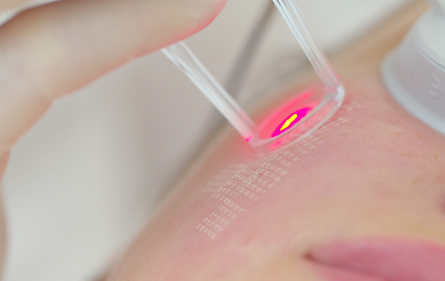co2 laser resurfacing, facial, scar removal, get rid of wrinkles, womens health clinic in douglas ga