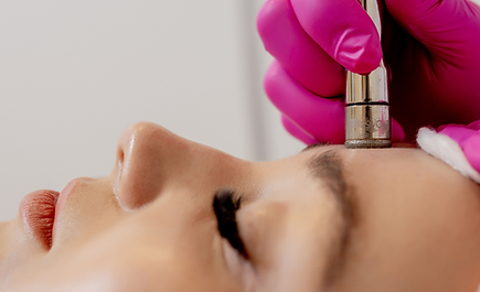 microdermabrasion, womens health clinic in douglas ga