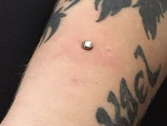Piercing Microdermal no Centro do Rio de Janeiro