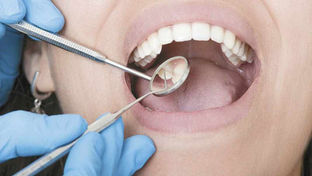 Medicamento japonés para regenerar dientes entró en ensayos clínicos en humanos