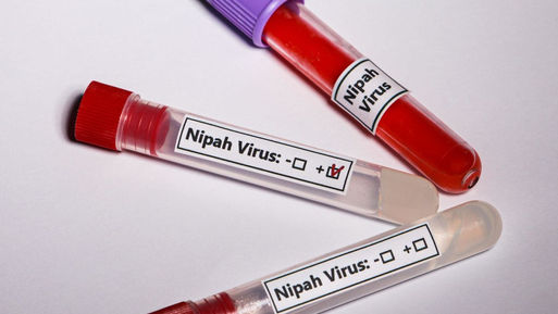 Un mortal virus que no tiene cura se propaga por la India. Los primeros casos se registraron esta semana en dos enfermeros de un hospital