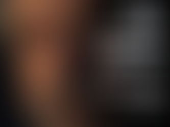 Cirurgia de catarata presidente LULA