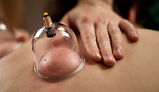 CUPPING