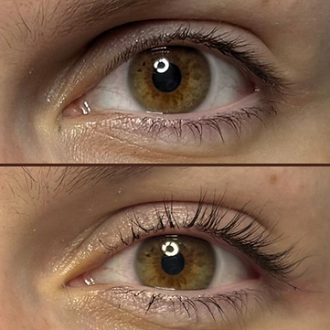 Simple Photocentric Before and After Instagram Post (1).png