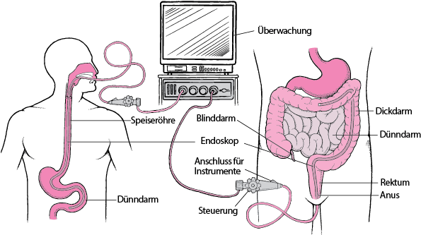 Endoskopie der Verdauungsorgane