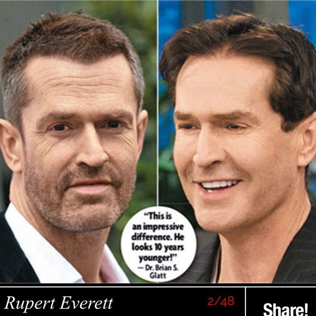 Rupert Everett
