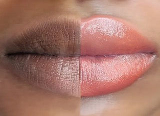 Best Dark Lip Neutralization in DMV