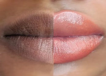 Best Dark Lip Neutralization in DMV