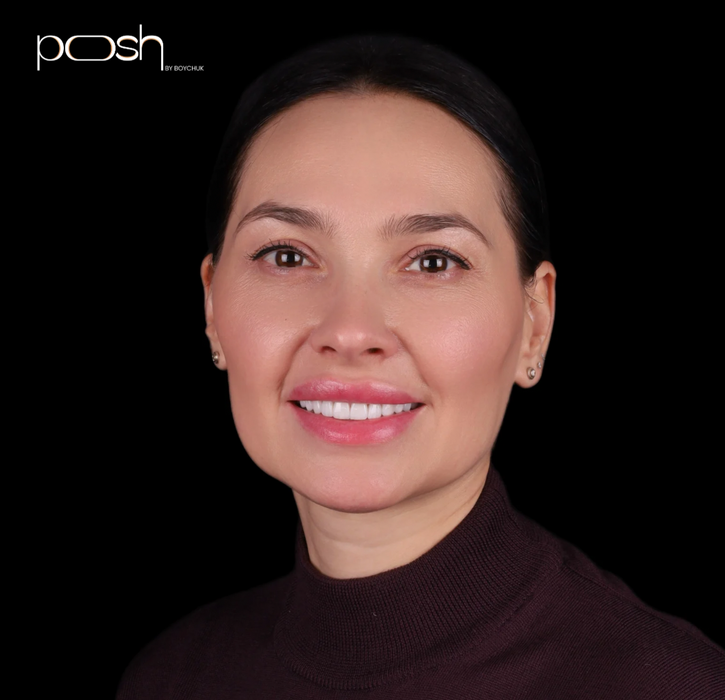 Жінка посміхається з білими зубами. Posh Dental 