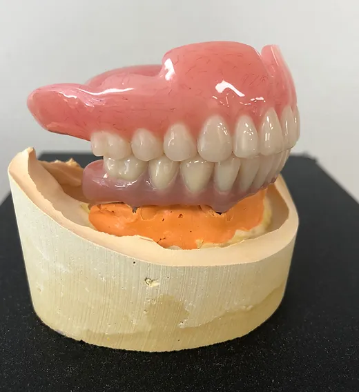 Dentures Spectrumdentalstudio
