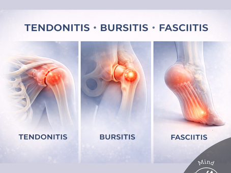 Illustration montrant comment une mauvaise répartition des charges et des schémas de mouvement contribuent aux tendinites et fasciites récurrentes.