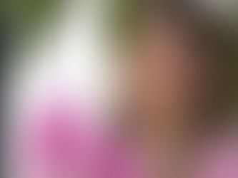 Toxina Botulínica Full Face: tratamento global com resultado mais natural