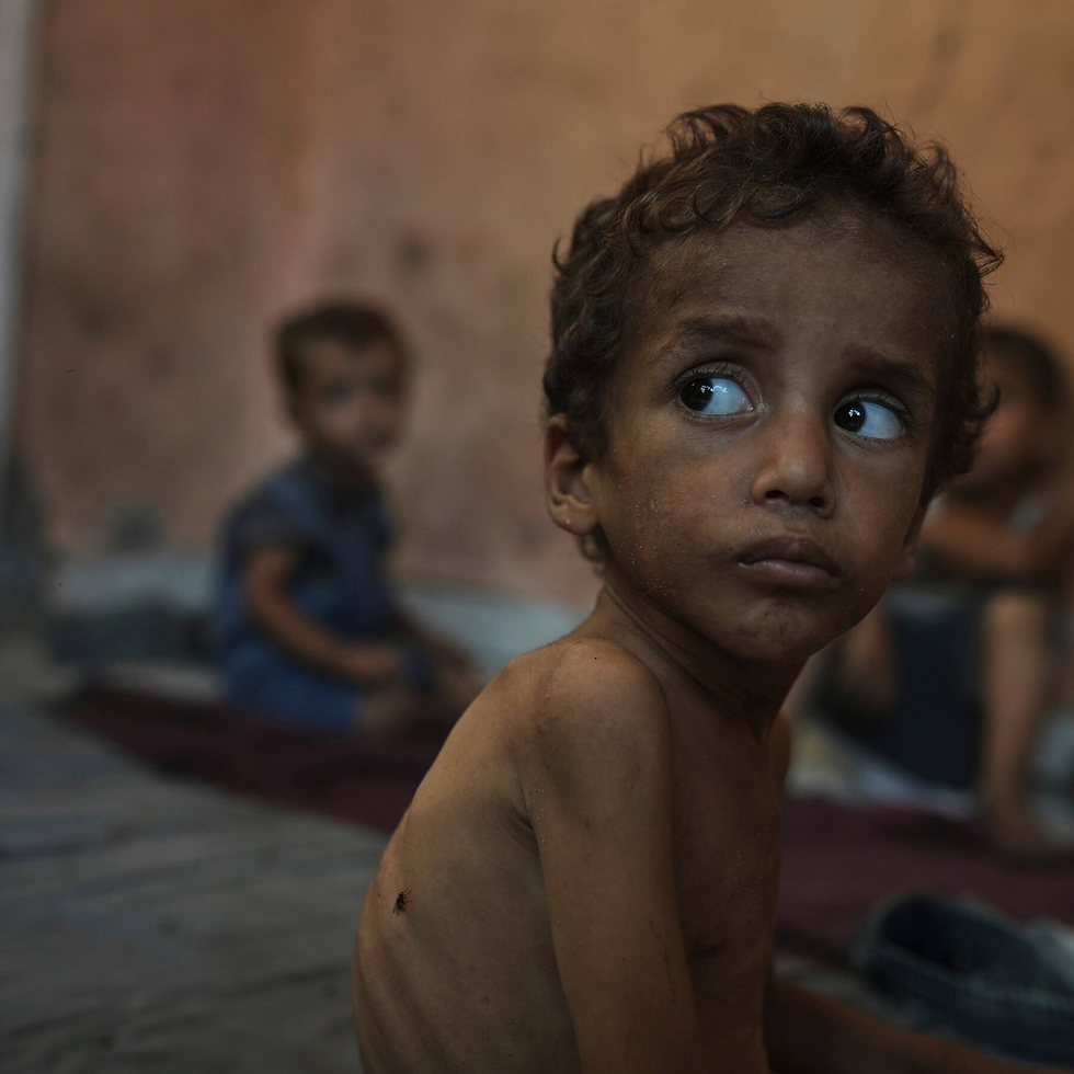 📸 La historia detrás de la fotografía símbolo del hambre en Gaza