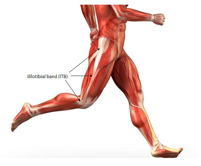 Iliotibial Band Syndrome a common cause of knee pain