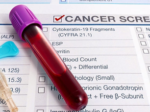 Galleri: The Cancer Test Everyone Is Talking About