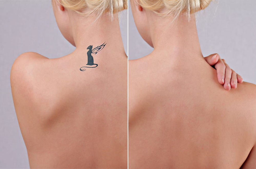 TATTOO