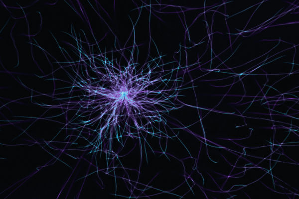 Monotropism & Hyperneuroplacticity