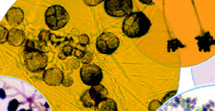 Magnified Mold.jpg