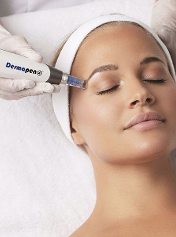 dermapen4_main.jpeg