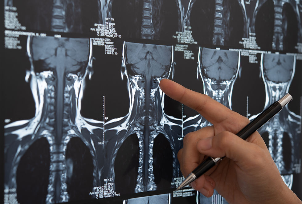 radiographie