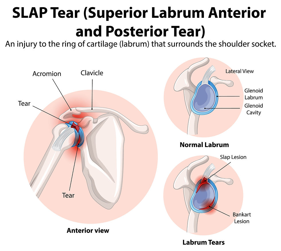 Le Labrum épaule