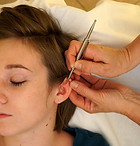 Ohrakupunktmassage