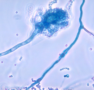 Aspergillus_fumigatus_01.jpg