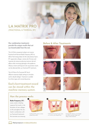 What is LA Matrix Pro?