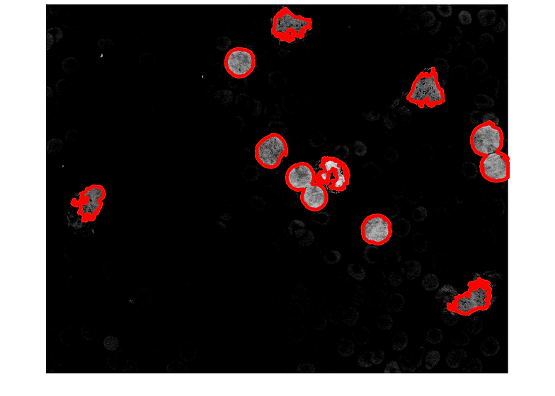 catch_tilted_cells_17.png