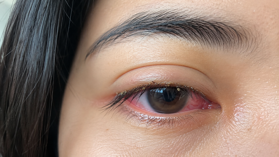 Lash Cleansing vs. Traditional Makeup Removal: Which Is Better for Allergy Relief? Here's everything you need to know