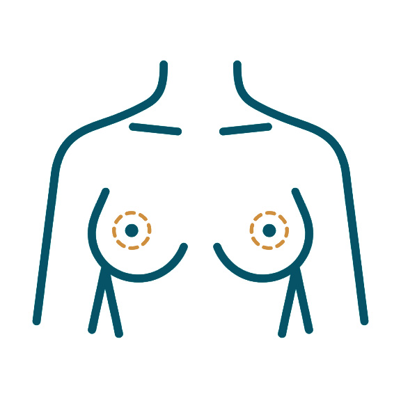 icon-standard-breast-lift-prodedure.jpg