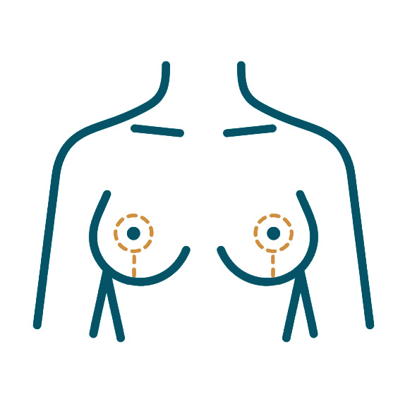 icon-keyhole-shape-breast-lift-prodedure.jpg