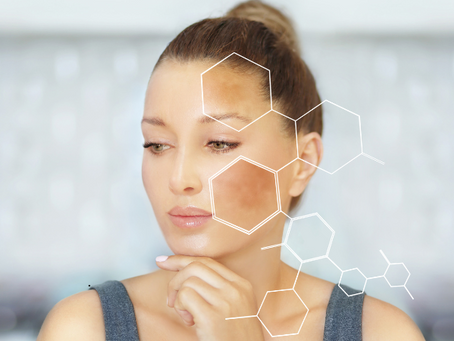 Melasma Treatment in Arlington