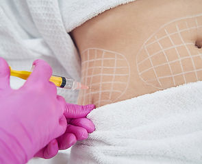 Fat Dissolving Bromley | Lemon Bottle & Aqualyx | Lees Aesthetics